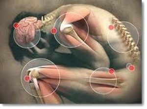 triquinosis imagen